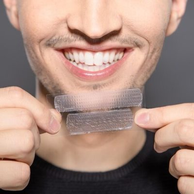 Comment utiliser un adhésif dentaire pour sauver votre sourire