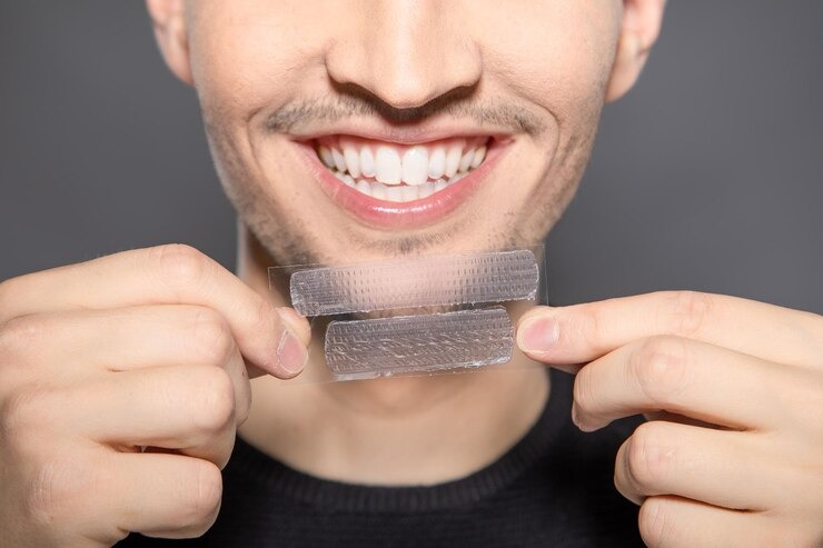 Comment utiliser un adhésif dentaire pour sauver votre sourire