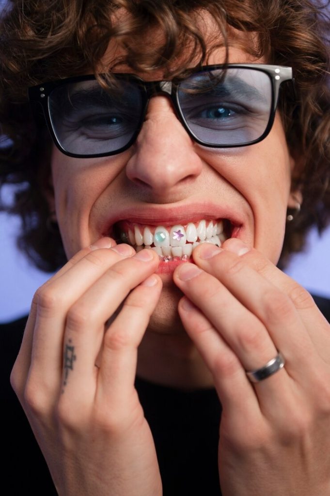 Tout ce que vous devez savoir sur la fausse dent à poser soi même : Votre guide pour un sourire au top sans vous ruiner