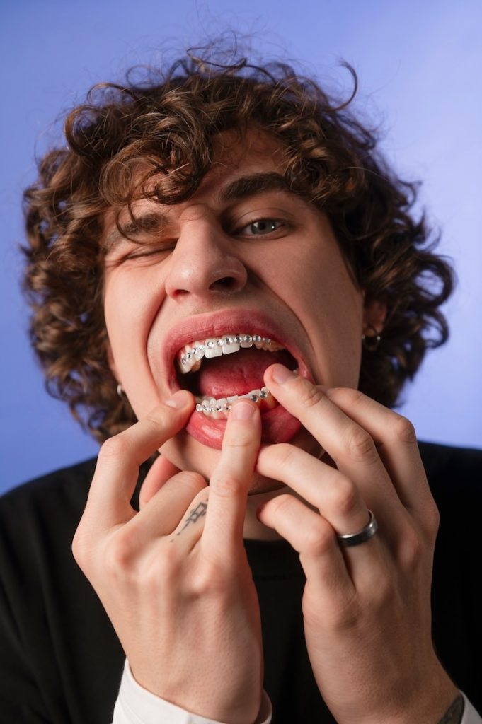 Se refaire les dents : Comment transformer ton sourire en un clin d’œil ?