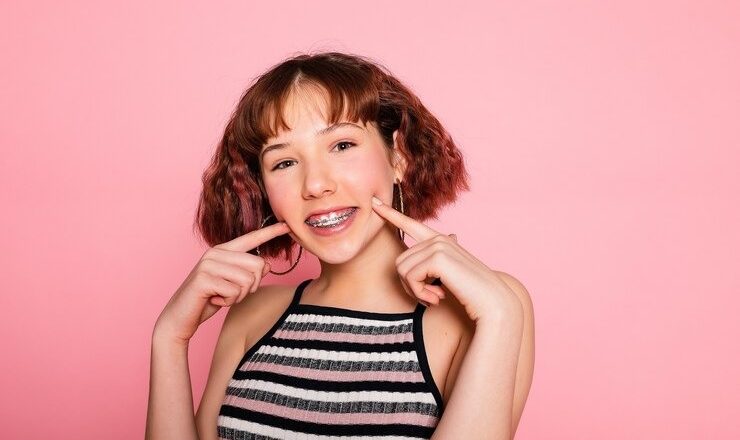 Vous cherchez une solution pour un sourire parfait ? Tout ce qu’il faut savoir sur la file dentaire !