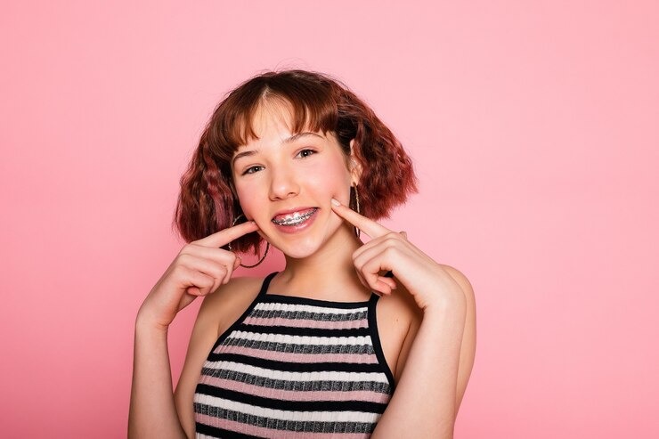 Vous cherchez une solution pour un sourire parfait ? Tout ce qu’il faut savoir sur la file dentaire !