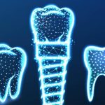 Comment booster votre sourire avec la technologie smart dent : le guide ultime pour des dents éclatantes