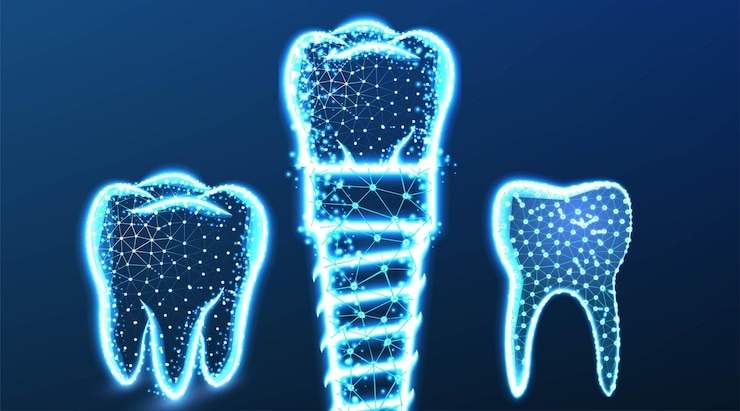 Comment booster votre sourire avec la technologie smart dent : le guide ultime pour des dents éclatantes