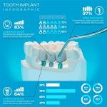Tout ce que vous devez savoir sur le prix d’un dentier : guide complet pour un sourire retrouvé