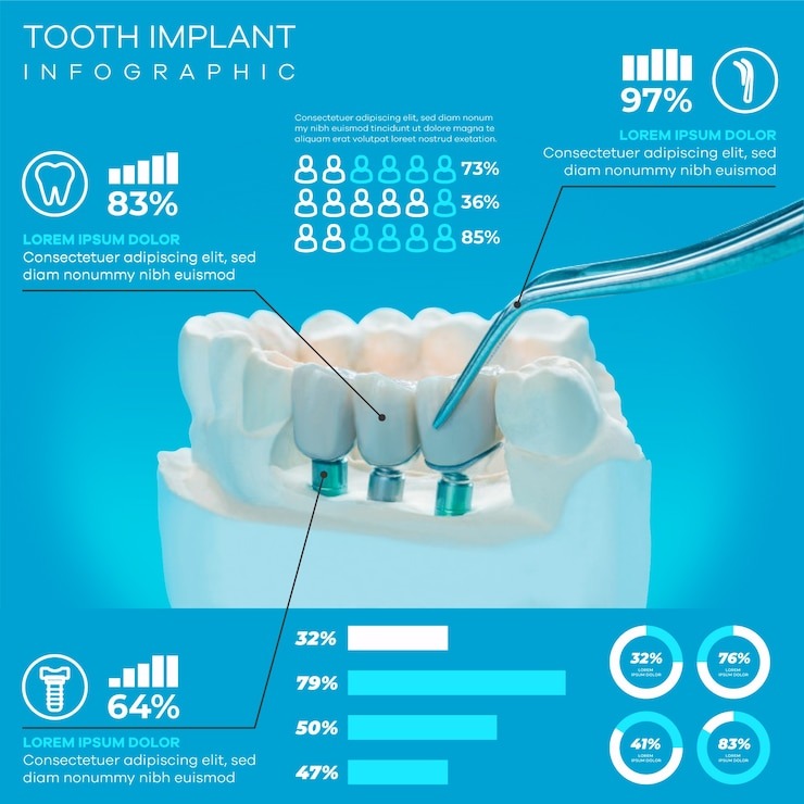 Tout ce que vous devez savoir sur le prix d’un dentier : guide complet pour un sourire retrouvé