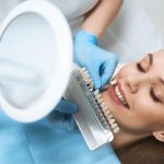 Facette prix : Tout ce que vous devez savoir pour un sourire de star sans vous ruiner