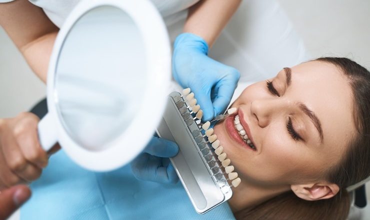 Facette prix : Tout ce que vous devez savoir pour un sourire de star sans vous ruiner