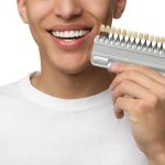 Combien coûtent les facettes dentaires ? Tout ce que vous devez savoir sur le prix facette