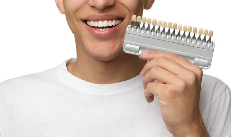 Combien coûtent les facettes dentaires ? Tout ce que vous devez savoir sur le prix facette