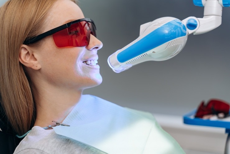 Comment choisir le meilleur blanchisseur dentaire pour un sourire qui claque