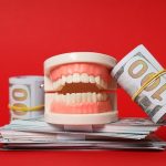 Dentier ventouse prix en Suisse : Tout ce que vous devez savoir pour un sourire au top !