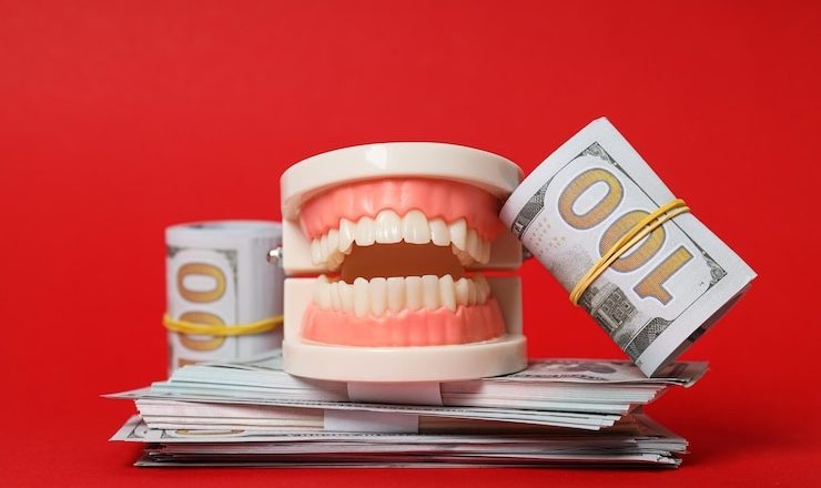 Dentier ventouse prix en Suisse : Tout ce que vous devez savoir pour un sourire au top !