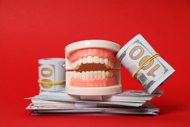 Dentier ventouse prix en Suisse : Tout ce que vous devez savoir pour un sourire au top !