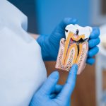 Guide complet pour tout savoir sur le plombadent : votre sourire mérite le meilleur
