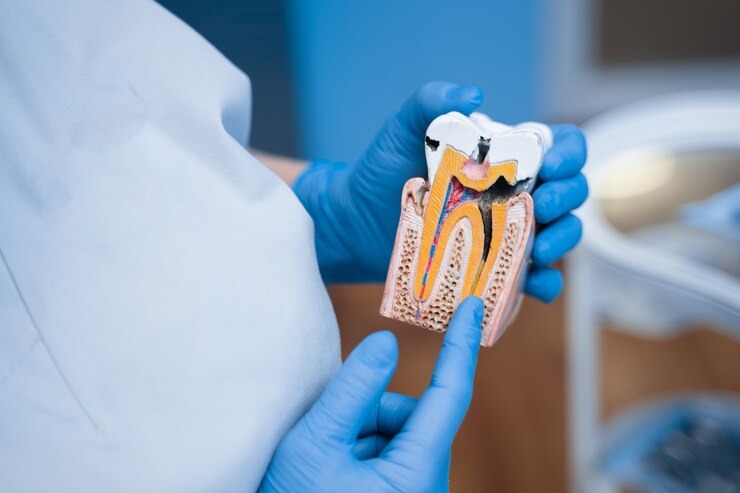 Guide complet pour tout savoir sur le plombadent : votre sourire mérite le meilleur