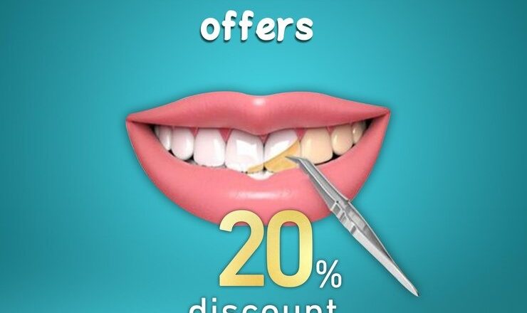 Prix détartrage complet : Comment garder vos dents clean sans vider votre portefeuille