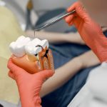 Comment traiter une carie comme un pro : tout ce que vous devez savoir sur le traitement carie