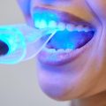 Comment transformer ton sourire avec Neo Dent : ton guide ultime pour des dents au top