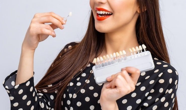Blanchiment dents prix : tout ce que vous devez savoir pour un sourire éclatant