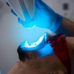 Vous rêvez d’un sourire éclatant ? Tout sur le blanchiment des dents prix au laser pour un sourire qui cartonne !