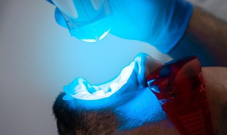 Vous rêvez d’un sourire éclatant ? Tout sur le blanchiment des dents prix au laser pour un sourire qui cartonne !