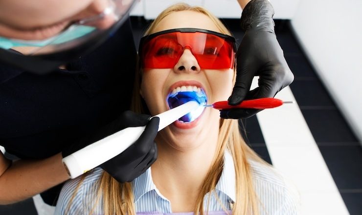 Quel est le meilleur blanchiment dentaire pour un sourire qui déchire en 2025 ?