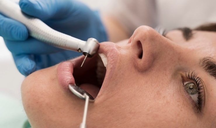 Détartreur dentaire : Votre arme secrète pour un sourire éclatant ou un gadget à éviter ?