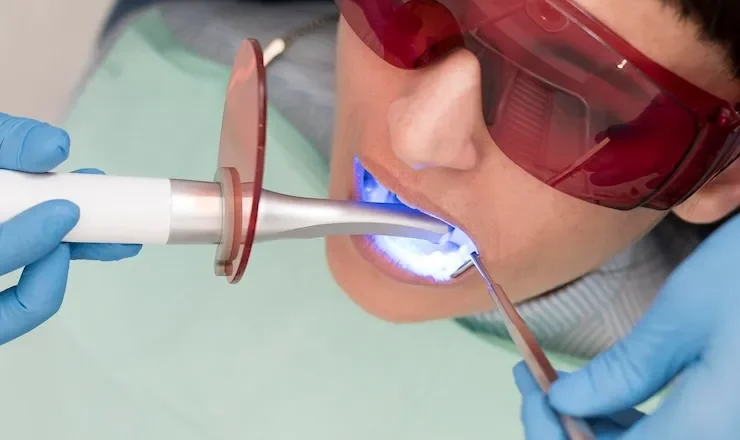 Comment trouver le meilleur soin dentaire avec Lapointe Dentiste : Ton guide pour un sourire au top