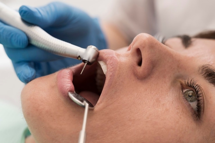 Détartreur dentaire : Votre arme secrète pour un sourire éclatant ou un gadget à éviter ?