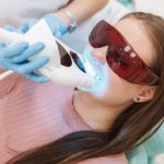 Vous rêvez d’un sourire éclatant sans produits chimiques agressifs ? Découvrez le blanchiment dentaire sans peroxyde !