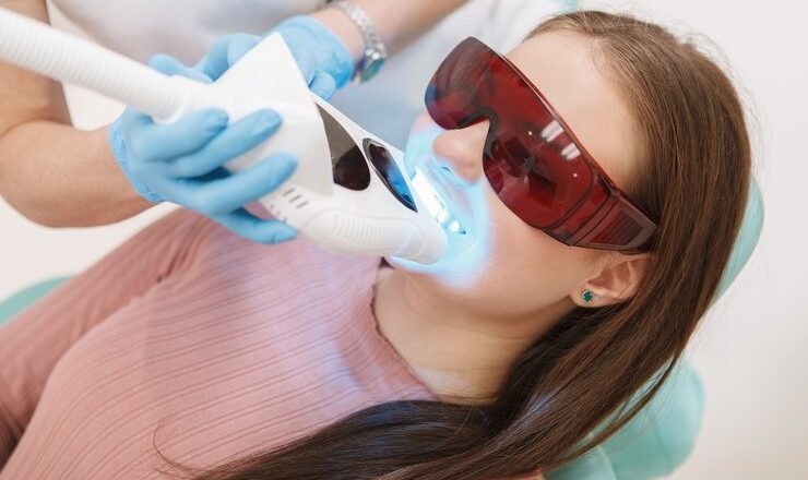 Vous rêvez d’un sourire éclatant sans produits chimiques agressifs ? Découvrez le blanchiment dentaire sans peroxyde !