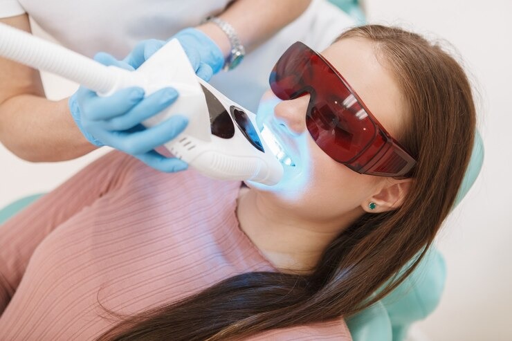 Vous rêvez d’un sourire éclatant sans produits chimiques agressifs ? Découvrez le blanchiment dentaire sans peroxyde !