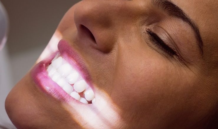 Vous rêvez d’un sourire éclatant ? Tout ce que vous devez savoir sur l’esthétique dentaire