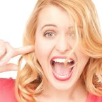 Comment Corriger les Dents qui se Chevauchent : Tout ce que Tu Dois Savoir