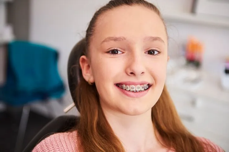 Tout savoir sur la broche dentaire : Guide ultime pour un sourire au top