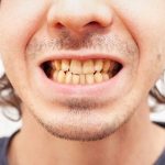 Comment soulager votre mal de gencive et dent comme un pro