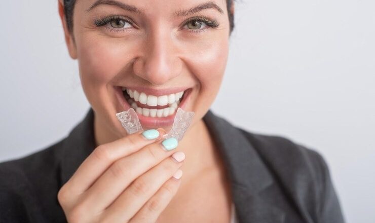 Tout sur la gouttière de blanchiment : prix, astuces et conseils pour un sourire éclatant