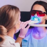 Envie d’un sourire éclatant ? Combien coûte un blanchiment dentaire en Suisse ?