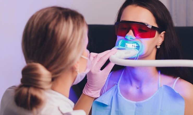 Envie d’un sourire éclatant ? Combien coûte un blanchiment dentaire en Suisse ?