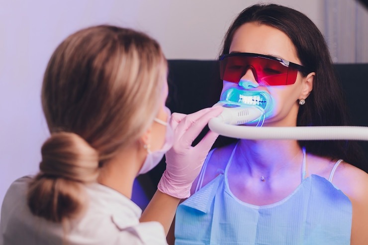 Envie d’un sourire éclatant ? Combien coûte un blanchiment dentaire en Suisse ?