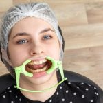 Comment gérer une gencive gonflée : solutions et astuces pour vous