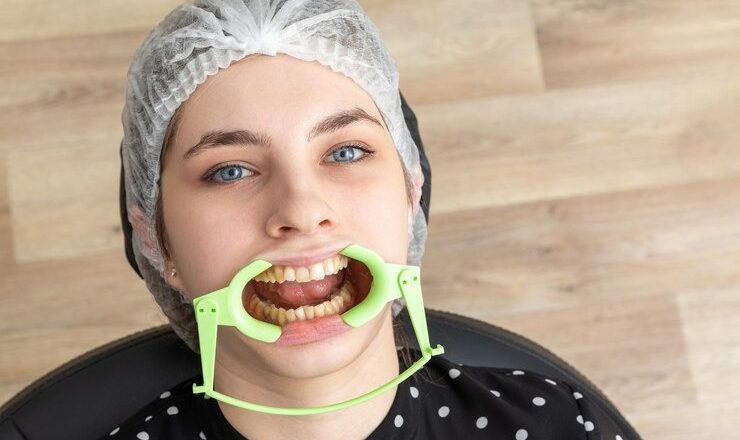 Comment gérer une gencive gonflée : solutions et astuces pour vous