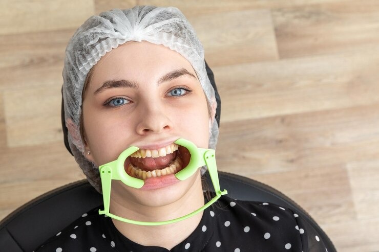 Comment gérer une gencive gonflée : solutions et astuces pour vous