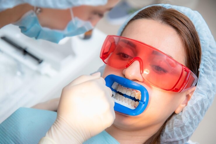 Comment obtenir un sourire éclatant avec Crest Blanchiment Dentaire : Le guide ultime pour des dents blanches
