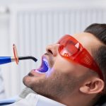 Tout ce que vous devez savoir sur le blanchissage de dents : Guide ultime pour un sourire éclatant !