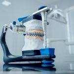 Tout ce que vous devez savoir sur l’ODF dentaire