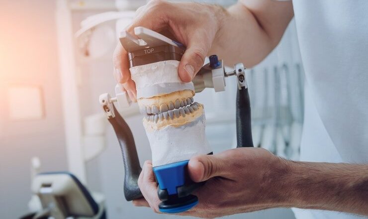 Comment trouver le meilleur dentiste prothésiste pour un sourire éclatant ?