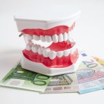 Tout ce que vous devez savoir sur le bridge dentaire tarif : Guide complet pour un sourire au top !