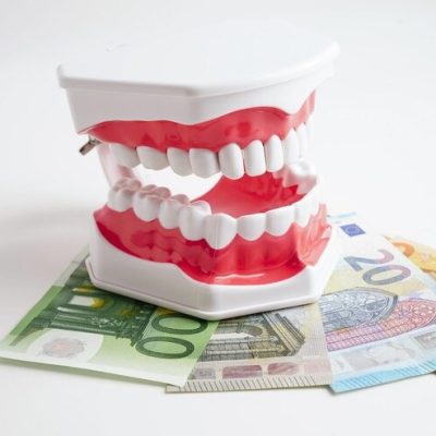 Tout ce que vous devez savoir sur le bridge dentaire tarif : Guide complet pour un sourire au top !